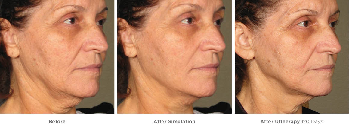 Ứng dụng của công nghệ in kỹ thuật số