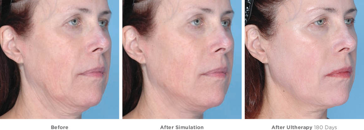 Tranh dán tường 3D mẫu phong thuỷ xì teen cute 1 Tranh dán tường 3D mẫu phong thuỷ xì teen cute